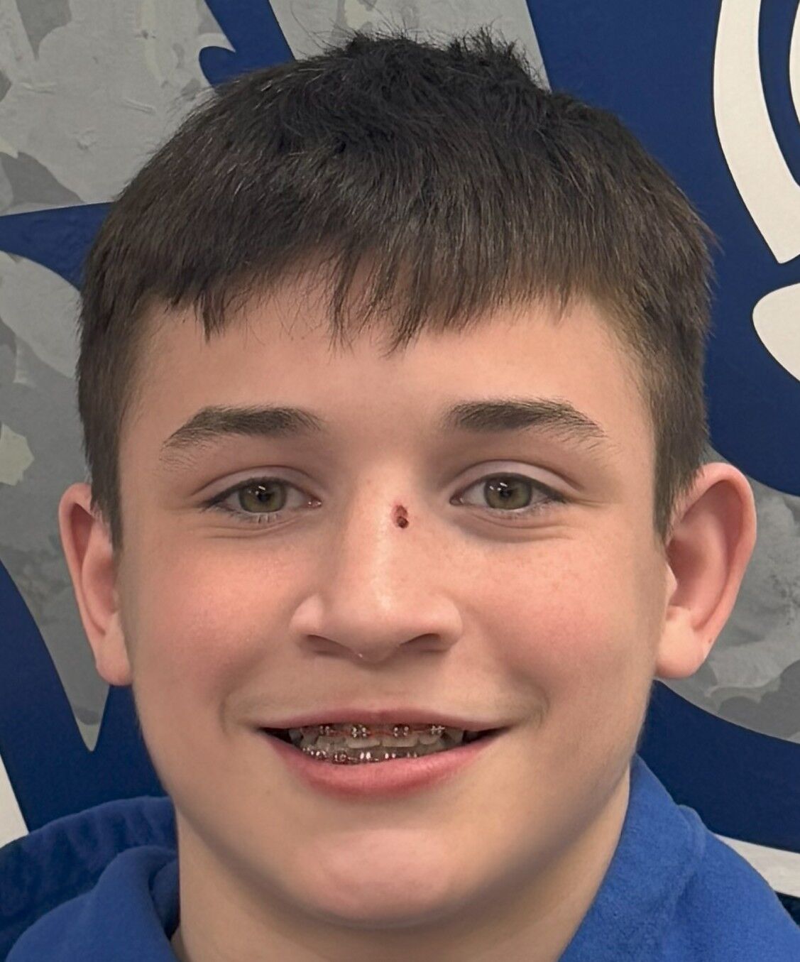 Caleb Dyer, Lutheran St. Charles